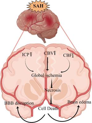 Molecular mechanisms of neuronal death in brain injury after subarachnoid hemorrhage